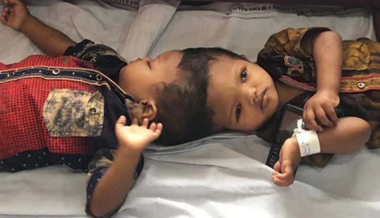 Odisha: One death due to separation of two children.