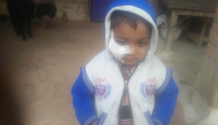 Kanpur: Stray monkey bled the child