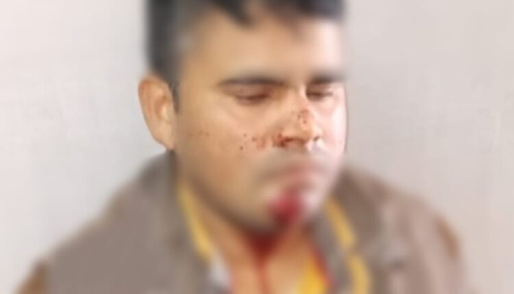 The gunfire struck the district again, sensation from unsuccessful robbery attempt