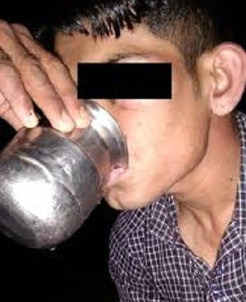 Young man beaten with iron rod, also fed urine