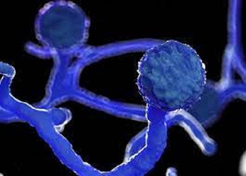 So far 35 people have lost eyes and 107 have jaw with teeth due to mucomycosis.