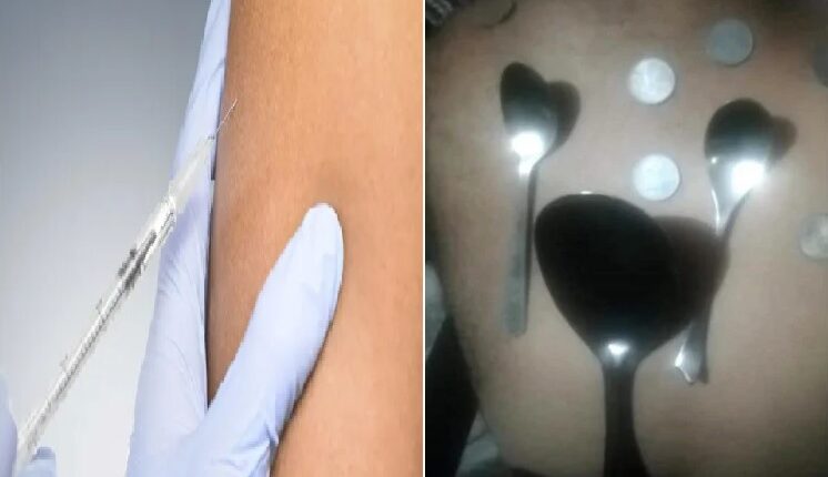 After getting the corona vaccine, such a case came that even the doctors were surprised to see, know what happened?