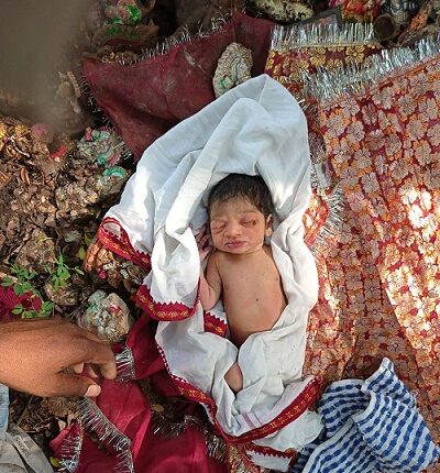 Jabalpur- Treatment of a one-day-old girl found in a garbage dump in Adhartal in Elgin