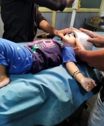 Cooker stuck in the head of one and a half year old innocent while playing, after hard efforts, doctors removed
