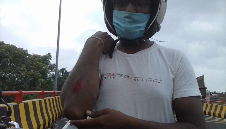 The deadly manjha is wreaking havoc on the passers-by, the administration is not paying its attention