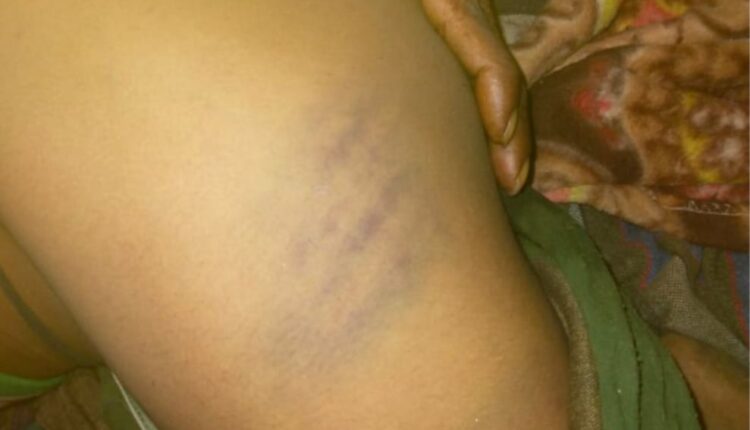 Teacher's beating took the life of a 12-year-old boy