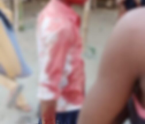 Violence with a 13-year-old child, the young man cut off both the ears, attacked the neck, the child saved his life like this