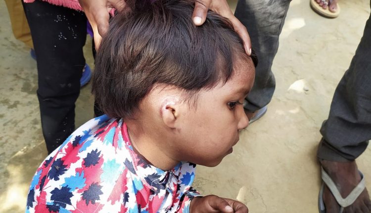 People of Nagla Mansingh area of ​​Aligarh, troubled by the terror of monkeys, eat children's ears