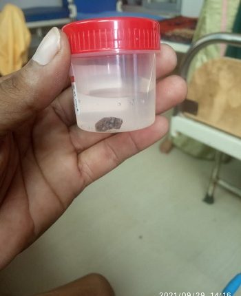 As soon as the news against the hospital spread, an influx of white-collars started coming to the woman's house.