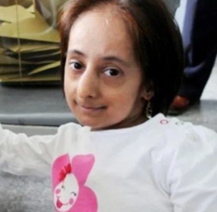 World's shortest woman Elif Kokaman dies, name is recorded in Guinness Book of World Records