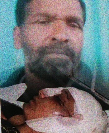 The merciless husband hit the 43-year-old wife with a hammer, the girl fighting for life