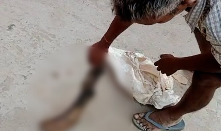 Shahab, my daughter was burnt alive by the in-laws, the helpless father reached the police station with the feet of her burnt daughter.