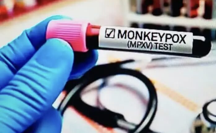 Thiruvananthapuram - The first patient of monkeypox in India recovered