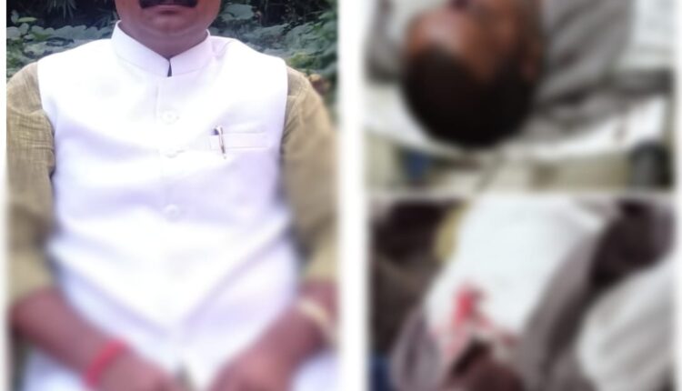 All India Public Welfare ABJ District President Jayant Mishra's motorcycle accident