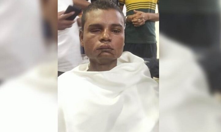 The victim who came out of the gang begging for 6 months after breaking his eyes told his own past