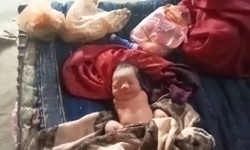 The girl child was born without hands became a topic of discussion