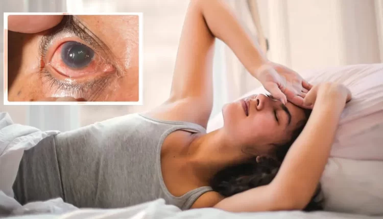 Risk of Cataract due to sleeping during the day by 2040 112 million people in the world may be affected