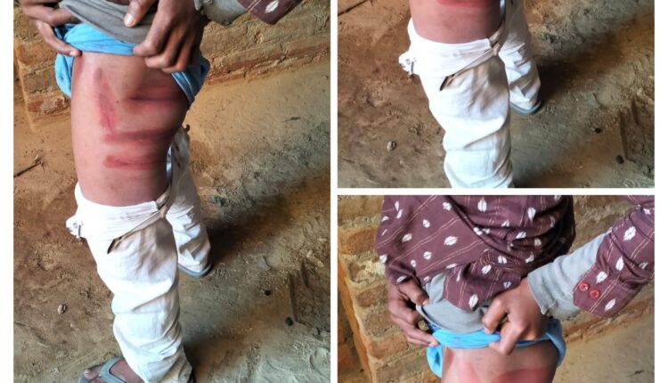 On the occasion of Republic Day, the teachers did cruelty to the child regarding Bundi