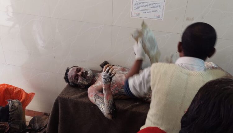 The young man roaming around the tehsil forced himself to commit self-immolation on Saturday