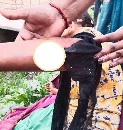 Husband brutally beat his wife for having a daughter, police filed a case on father's Tahrir