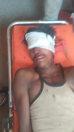 Youth fell from 30 feet electric pole