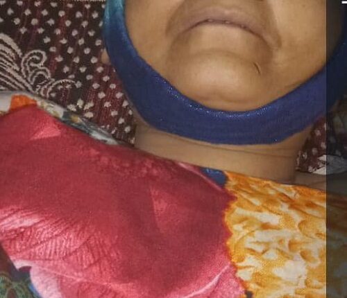 Harassment of woman at Ikka stand sub-centre killed her