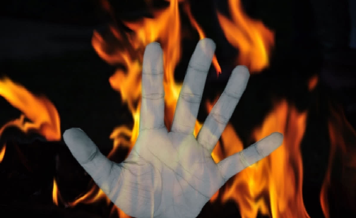 Class VIII student sets herself on fire in Odisha's Bargarh, condition critical